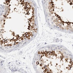 C9orf50 Antibody, Novus Biologicals 25 &mu;L, Unlabeled:Antibodies, Polyclonal