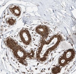 C9orf66 Antibody, Novus Biologicals 25 &mu;L | Buy Online | Novus Biologicals | Fisher Scientific
