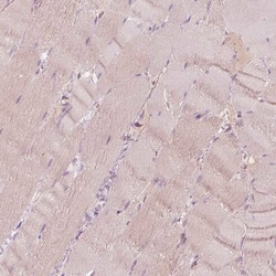 SPATA6L Antibody, Novus Biologicals:Antibodies:Primary Antibodies