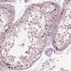 SPATA6L Antibody, Novus Biologicals:Antibodies:Primary Antibodies