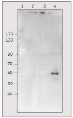 C9orf72 Antibody, Novus Biologicals 100 &mu;g | Buy Online | Novus Biologicals | Fisher Scientific