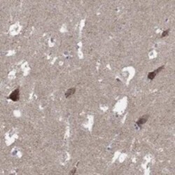 C9orf85 Rabbit anti-Human, Polyclonal, Novus Biologicals 100 &mu;g | Buy Online | Bio-Techne | Fisher Scientific