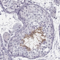 C9orf9 Antibody, Novus Biologicals 25 &mu;L; Unlabeled:Antibodies, Polyclonal