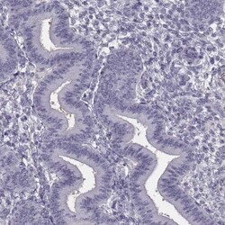 C9orf9 Antibody, Novus Biologicals 25 &mu;L; Unlabeled:Antibodies, Polyclonal