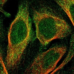 TMEM268 Antibody, Novus Biologicals 25 &mu;L; Unlabeled:Antibodies, Polyclonal