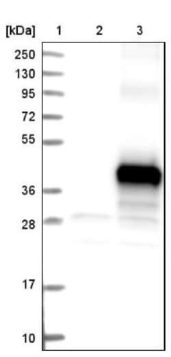 TMEM268 Antibody, Novus Biologicals 25 &mu;L; Unlabeled:Antibodies, Polyclonal
