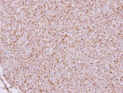 CAB39 Antibody, Novus Biologicals 0.1mL; Unlabeled:Antibodies, Polyclonal