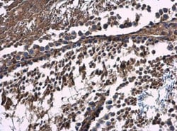 CAB39 Antibody, Novus Biologicals 0.1mL; Unlabeled:Antibodies, Polyclonal