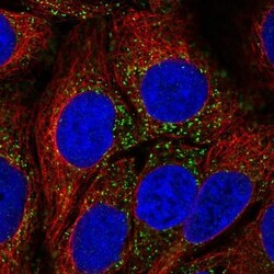 CAB39L Antibody, Novus Biologicals:Antibodies:Primary Antibodies