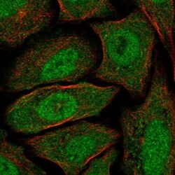 CABYR Antibody, Novus Biologicals 0.1mL; Unlabeled:Antibodies, Polyclonal