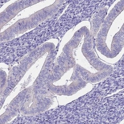 CABYR Antibody, Novus Biologicals 0.1mL; Unlabeled:Antibodies, Polyclonal