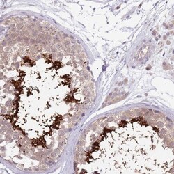 CABYR Antibody, Novus Biologicals 0.1mL; Unlabeled:Antibodies, Polyclonal