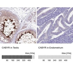 CABYR Antibody, Novus Biologicals 0.1mL; Unlabeled:Antibodies, Polyclonal