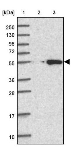 CABYR Antibody, Novus Biologicals 0.1mL; Unlabeled:Antibodies, Polyclonal