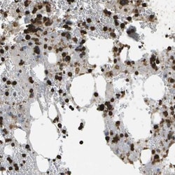 CACHD1 Antibody, Novus Biologicals:Antibodies:Primary Antibodies