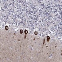 CACNA1A Rabbit, Polyclonal, Novus Biologicals 25 &mu;L; Unconjugated:Antibodies,