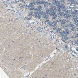 CACNA2D1 Antibody, Novus Biologicals 25 &mu;L; Unlabeled:Antibodies, Polyclonal