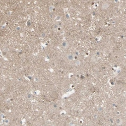 CACNA2D1 Antibody, Novus Biologicals 25 &mu;L; Unlabeled:Antibodies, Polyclonal