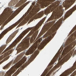 CACNA2D1 Antibody, Novus Biologicals 25 &mu;L; Unlabeled:Antibodies, Polyclonal