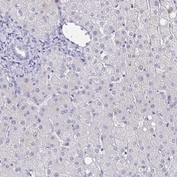 CACNA2D2 Antibody, Novus Biologicals 0.1mL; Unlabeled:Antibodies, Polyclonal
