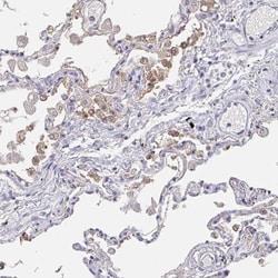 CACNA2D2 Antibody, Novus Biologicals 0.1mL; Unlabeled:Antibodies, Polyclonal