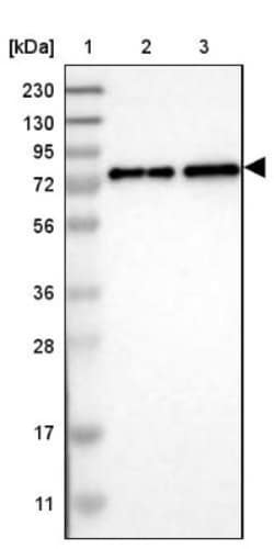 CACNB4 Antibody, Novus Biologicals 0.1mL; Unlabeled:Antibodies, Polyclonal