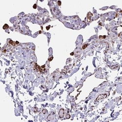 CACNG3 Antibody, Novus Biologicals 0.1mL; Unlabeled:Antibodies, Polyclonal