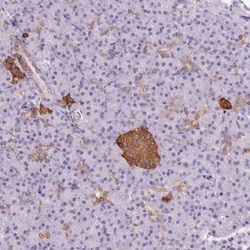 CADPS Antibody, Novus Biologicals:Antibodies:Primary Antibodies