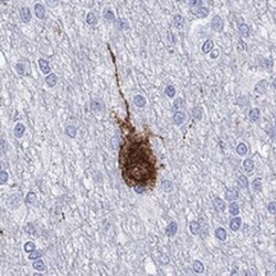 CALHM1 Rabbit anti-Human, Polyclonal, Novus Biologicals 25 &mu;g; Unconjugated:Antibodies,