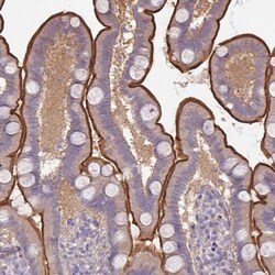 CALML4 Antibody, Novus Biologicals 0.1mL; Unlabeled:Antibodies, Polyclonal