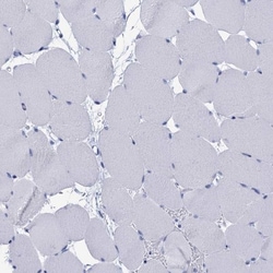 CALML5 Antibody, Novus Biologicals 25 &mu;L; Unlabeled:Antibodies, Polyclonal