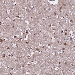 CALY Antibody, Novus Biologicals 25 &mu;L; Unlabeled:Antibodies, Polyclonal