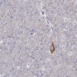 CALY Antibody, Novus Biologicals 25 &mu;L; Unlabeled:Antibodies, Polyclonal