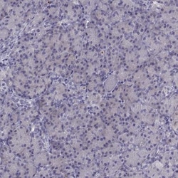 CALY Antibody, Novus Biologicals 25 &mu;L; Unlabeled:Antibodies, Polyclonal