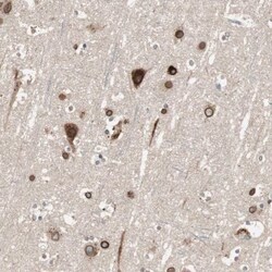 CAMKID Antibody, Novus Biologicals 25 &mu;L; Unlabeled:Antibodies, Polyclonal