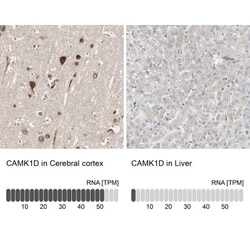 CAMKID Antibody, Novus Biologicals 25 &mu;L; Unlabeled:Antibodies, Polyclonal