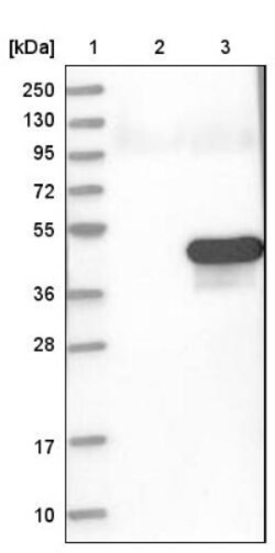 CAMKID Antibody, Novus Biologicals 25 &mu;L; Unlabeled:Antibodies, Polyclonal