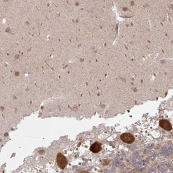 CAMLG Antibody, Novus Biologicals 25 &mu;L, Unlabeled:Antibodies, Polyclonal