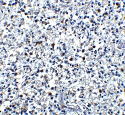 CAMP/LL37/FALL39/Cathelicidin Antibody - BSA Free, Novus Biologicals 0.1mg;