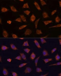 CAMSAP1 Rabbit anti-Human, Mouse, Polyclonal, Novus Biologicals 100 &mu;g;