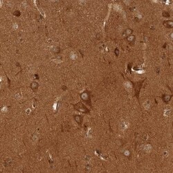 CAMSAP1L1 Antibody, Novus Biologicals:Antibodies:Primary Antibodies