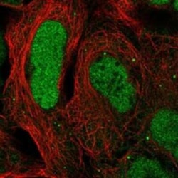 CAMTA2 Rabbit anti-Human, Polyclonal, Novus Biologicals 25 &mu;g | Buy Online | Novus Biologicals | Fisher Scientific