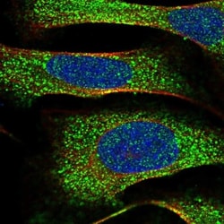 CAP1 Antibody, Novus Biologicals 0.1mL; Unlabeled:Antibodies, Polyclonal
