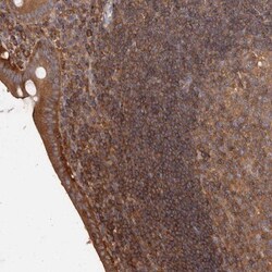 CAP1 Antibody, Novus Biologicals 0.1mL; Unlabeled:Antibodies, Polyclonal