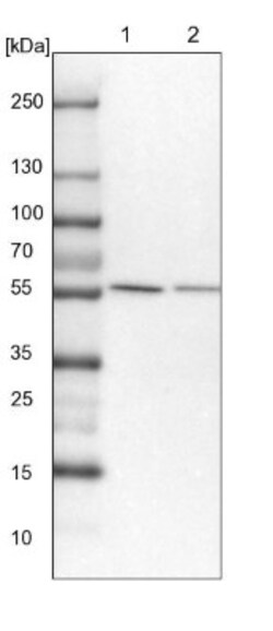 CAP1 Antibody, Novus Biologicals 0.1mL; Unlabeled:Antibodies, Polyclonal
