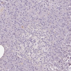 CAP2 Antibody, Novus Biologicals:Antibodies:Primary Antibodies