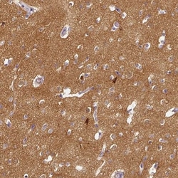 CAP2 Antibody, Novus Biologicals 0.1mL; Unlabeled:Antibodies, Polyclonal