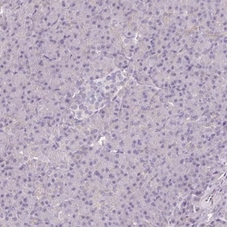 CAP2 Antibody, Novus Biologicals 0.1mL; Unlabeled:Antibodies, Polyclonal
