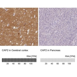 CAP2 Antibody, Novus Biologicals 0.1mL; Unlabeled:Antibodies, Polyclonal
