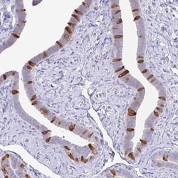 CAPSL Antibody, Novus Biologicals:Antibodies:Primary Antibodies